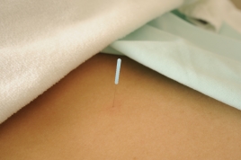 鍼灸院爽快館西葛西店 鍼灸治療のメニュー画像