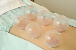 鍼灸院爽快館西葛西店 吸玉のメニュー画像