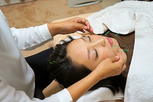 美容鍼灸 Harico 基本のHarico60分～70分　 Basicのメニュー画像