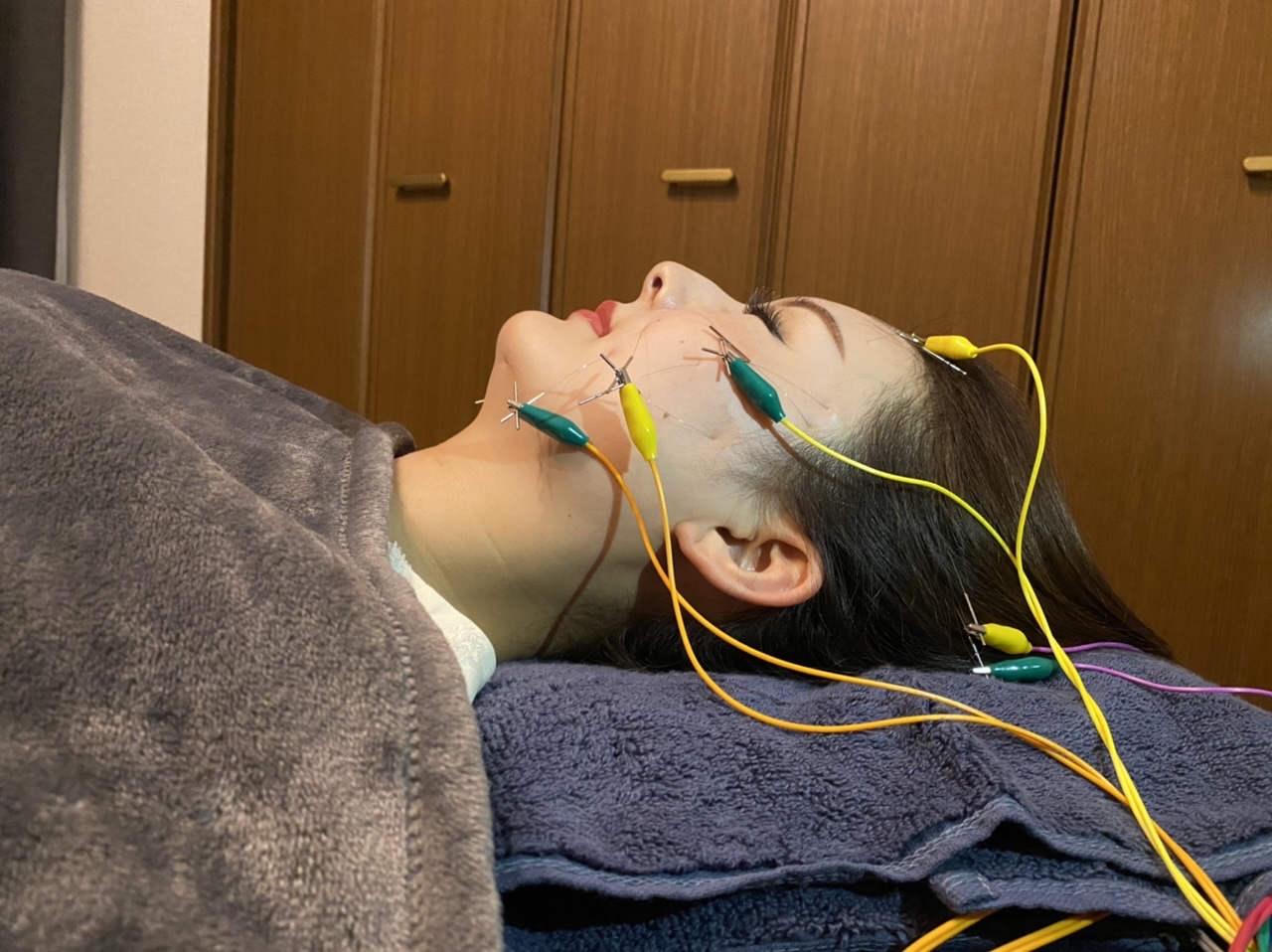 シュエット BODY CARE / 治療院 シュエット美鍼のメニュー画像