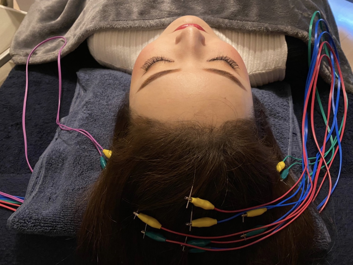 シュエット BODY CARE / 治療院 電気を流す美髪鍼のメニュー画像