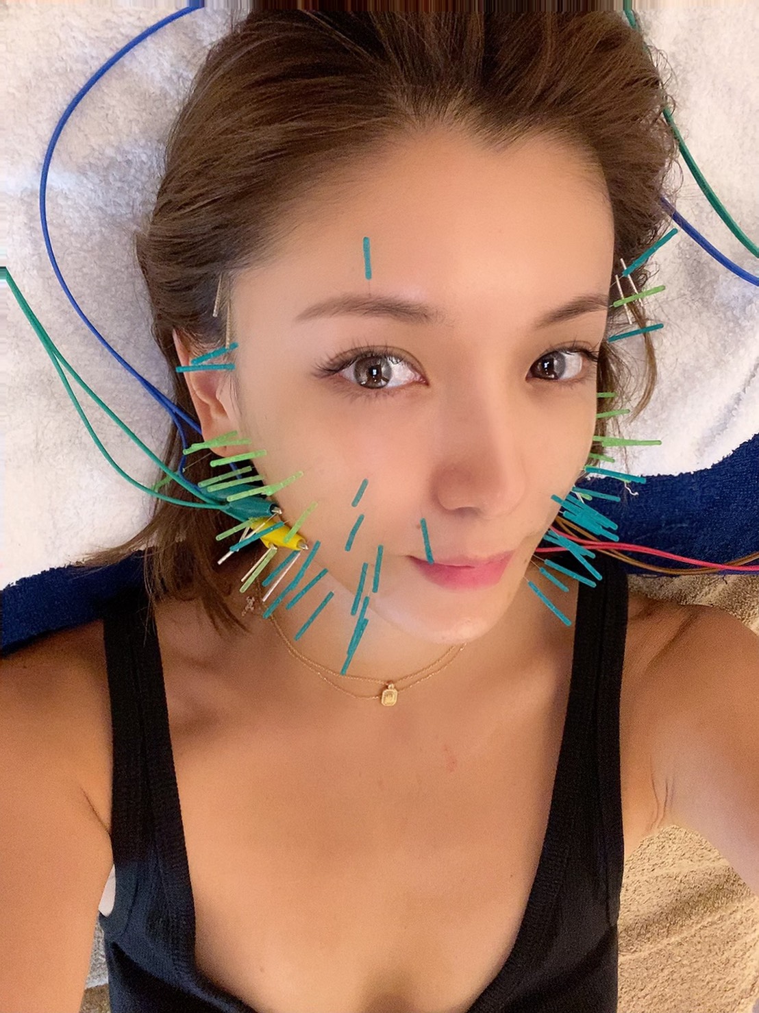 HARI整体サロン 美容鍼（初回）のメニュー画像