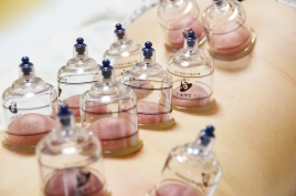 こもれび鍼灸院 吸い玉　2回目以降のメニュー画像