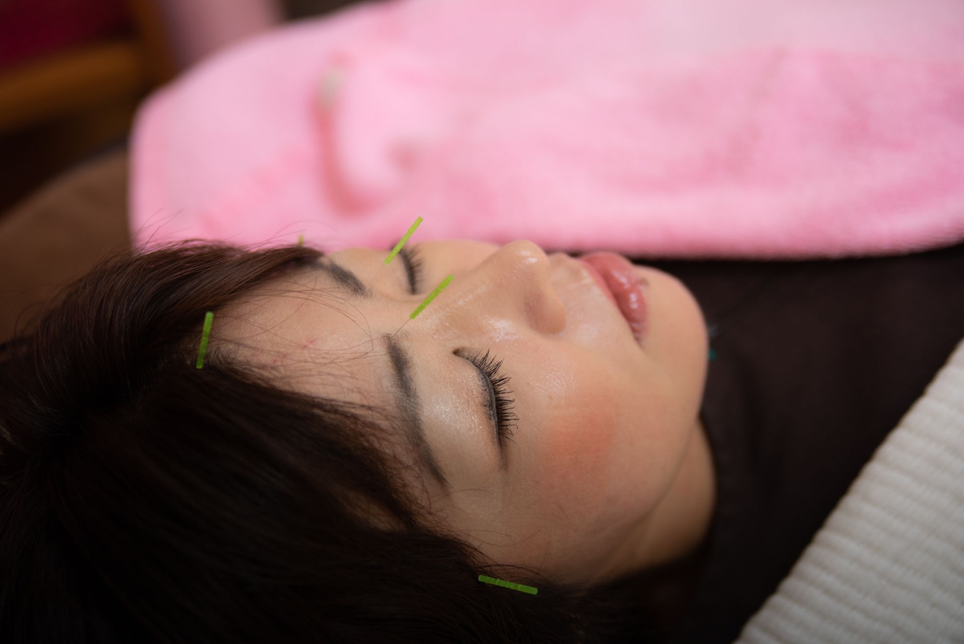 さくら鍼灸院 初回・美容鍼(美顔＋鍼灸整体）(2枠）のメニュー画像
