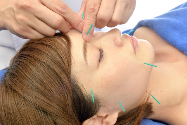 女性と子どものためのはり・きゅう治療院　Mother Earth 美容鍼＆整体（ベーシック40分）のメニュー画像