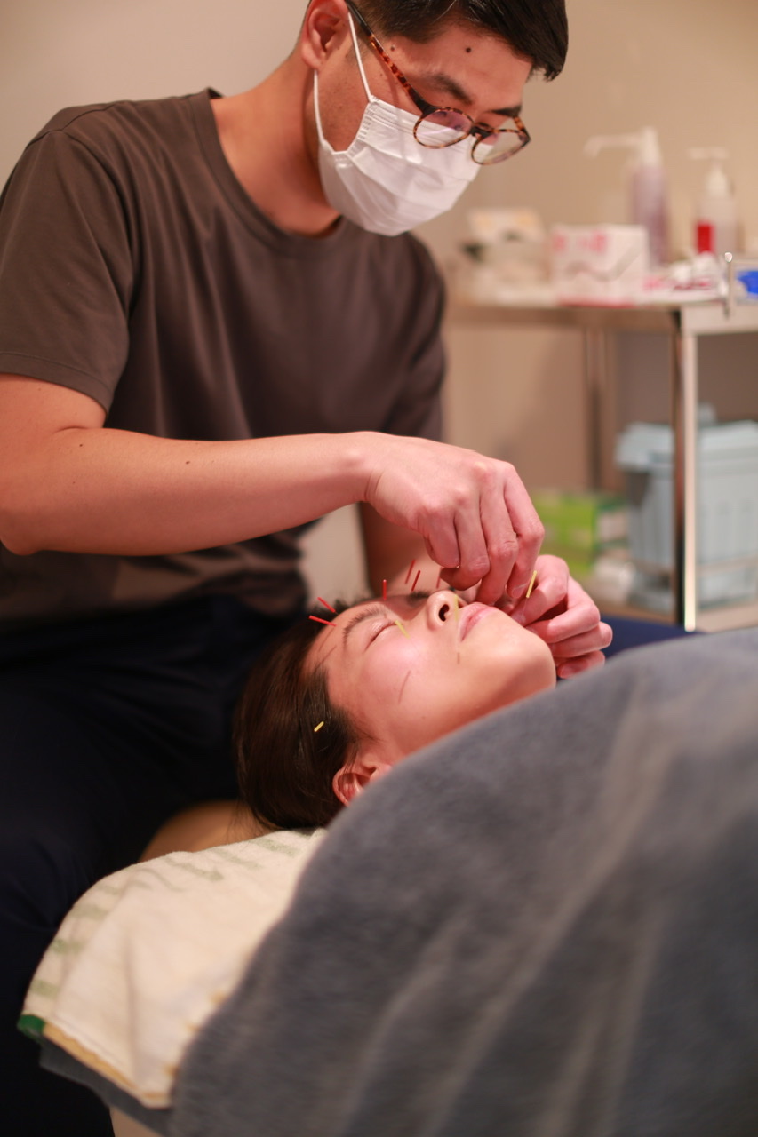 ハリトレ鍼灸院 美容鍼トライアルコースのメニュー画像