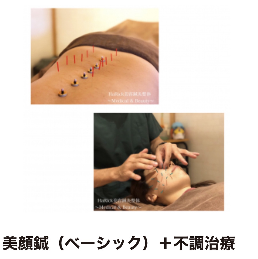 HaRick 美容鍼灸整体 美顔鍼＋不調治療（リフトアップ＋肩こりや腰痛）のメニュー画像