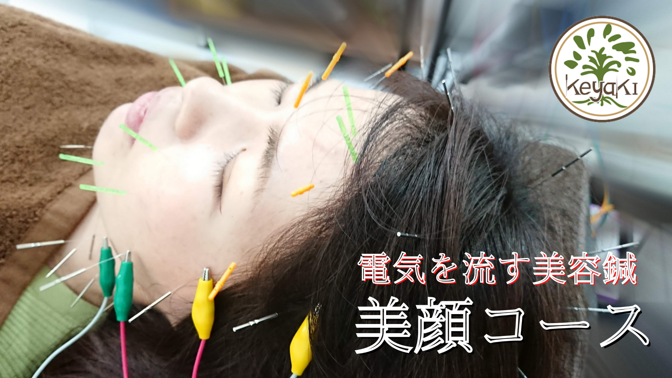 鍼灸・美容鍼サロンKEYAKI　自由が丘院 【お試しにも最適】美顔　◆40本の鍼に電気を流す美容鍼◆のメニュー画像