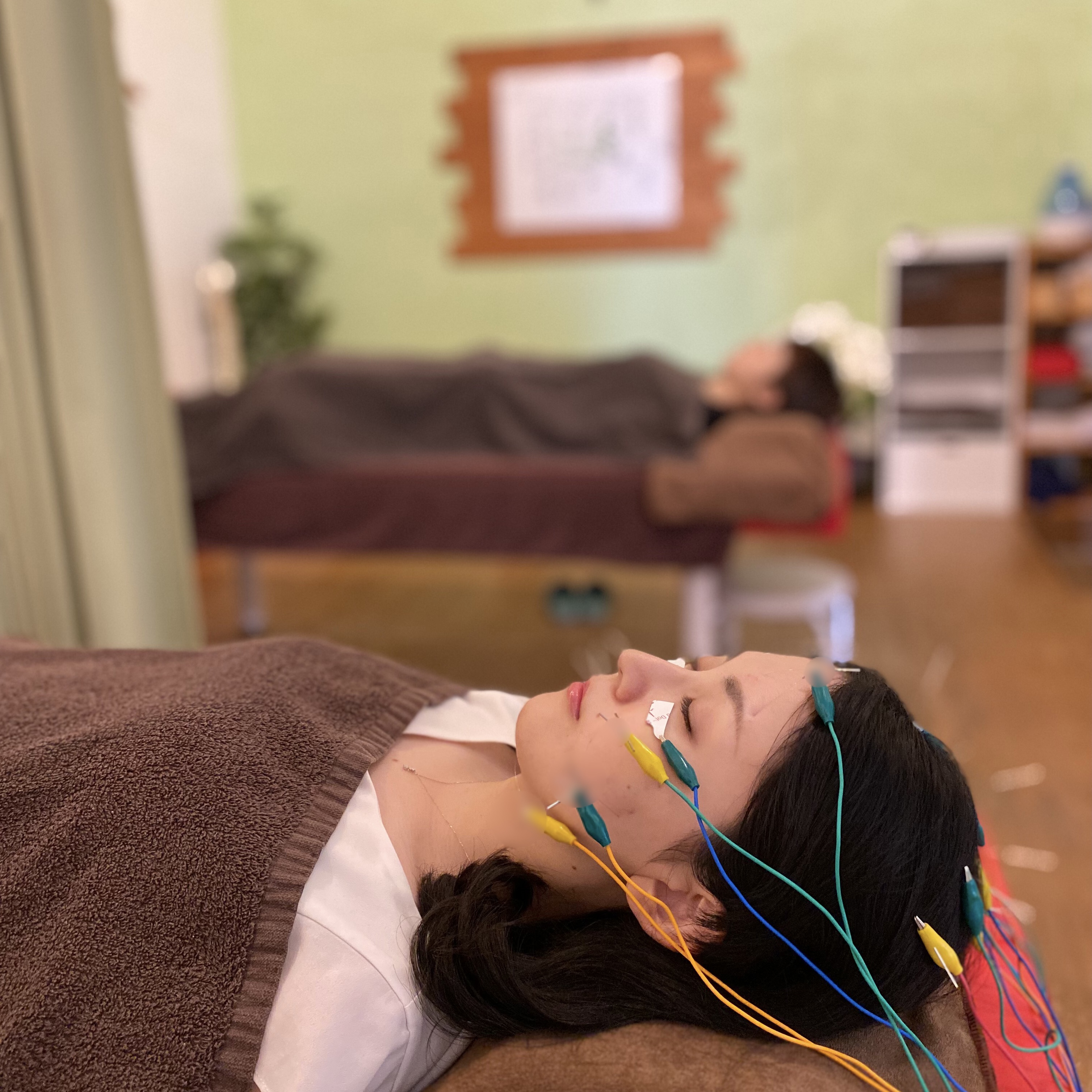 鍼灸マッサージLifeBuddy ●【初回限定・ペア割・42本】顔全体に電気を流す美容鍼×2人のメニュー画像