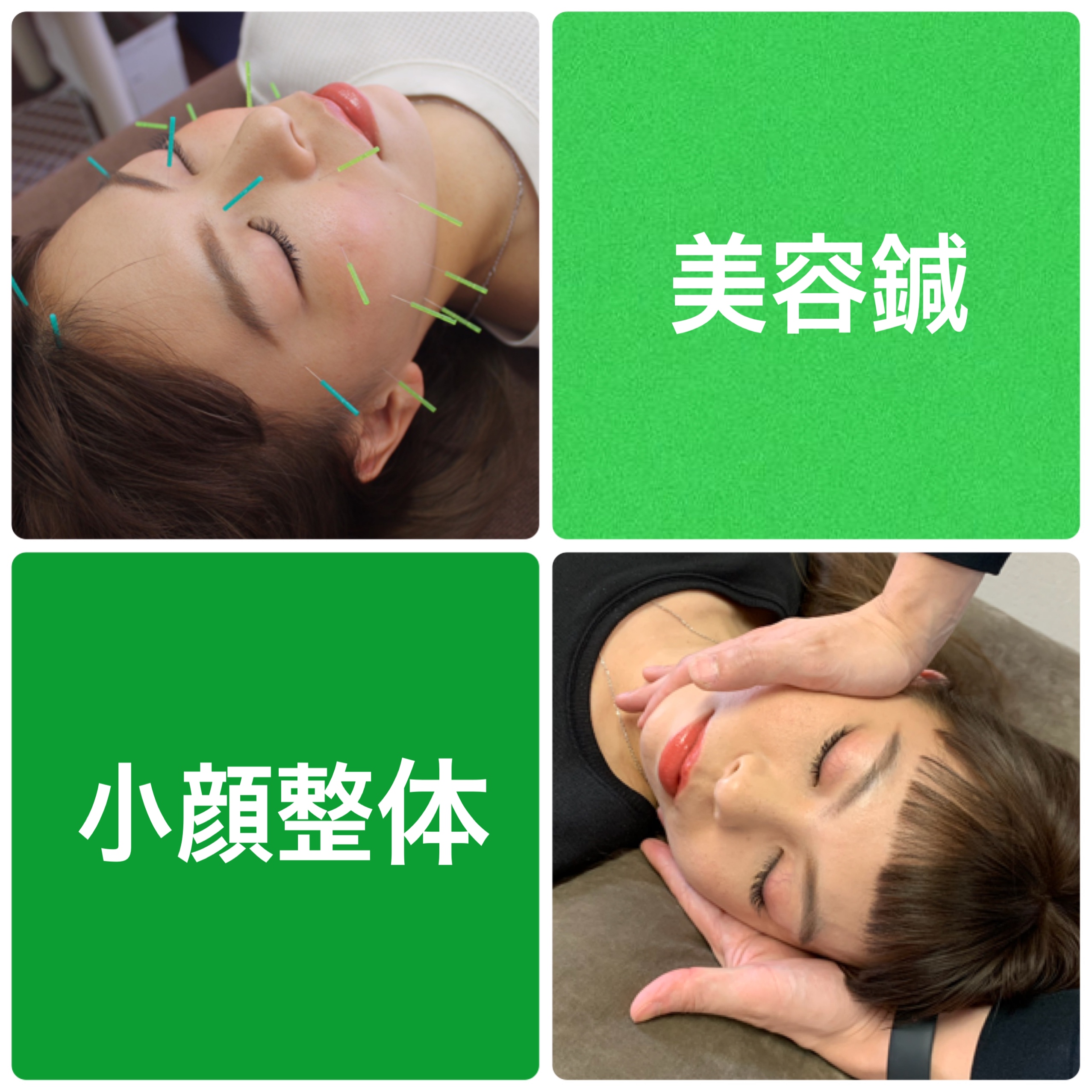 同心整骨院 【  美容鍼 + 小顔整体  】のメニュー画像