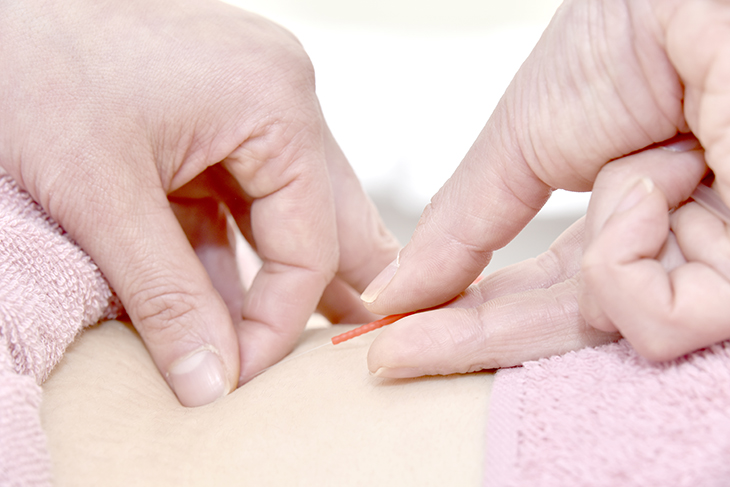 女性のための鍼灸院・マッサージ院-ゆしんアネックス- 全身鍼灸施術のメニュー画像