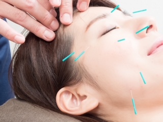 神宮はり灸接骨院 Face鍼灸(20分)※1部位のメニュー画像