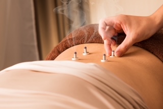 神宮はり灸接骨院 Ladies鍼灸(30分)のメニュー画像