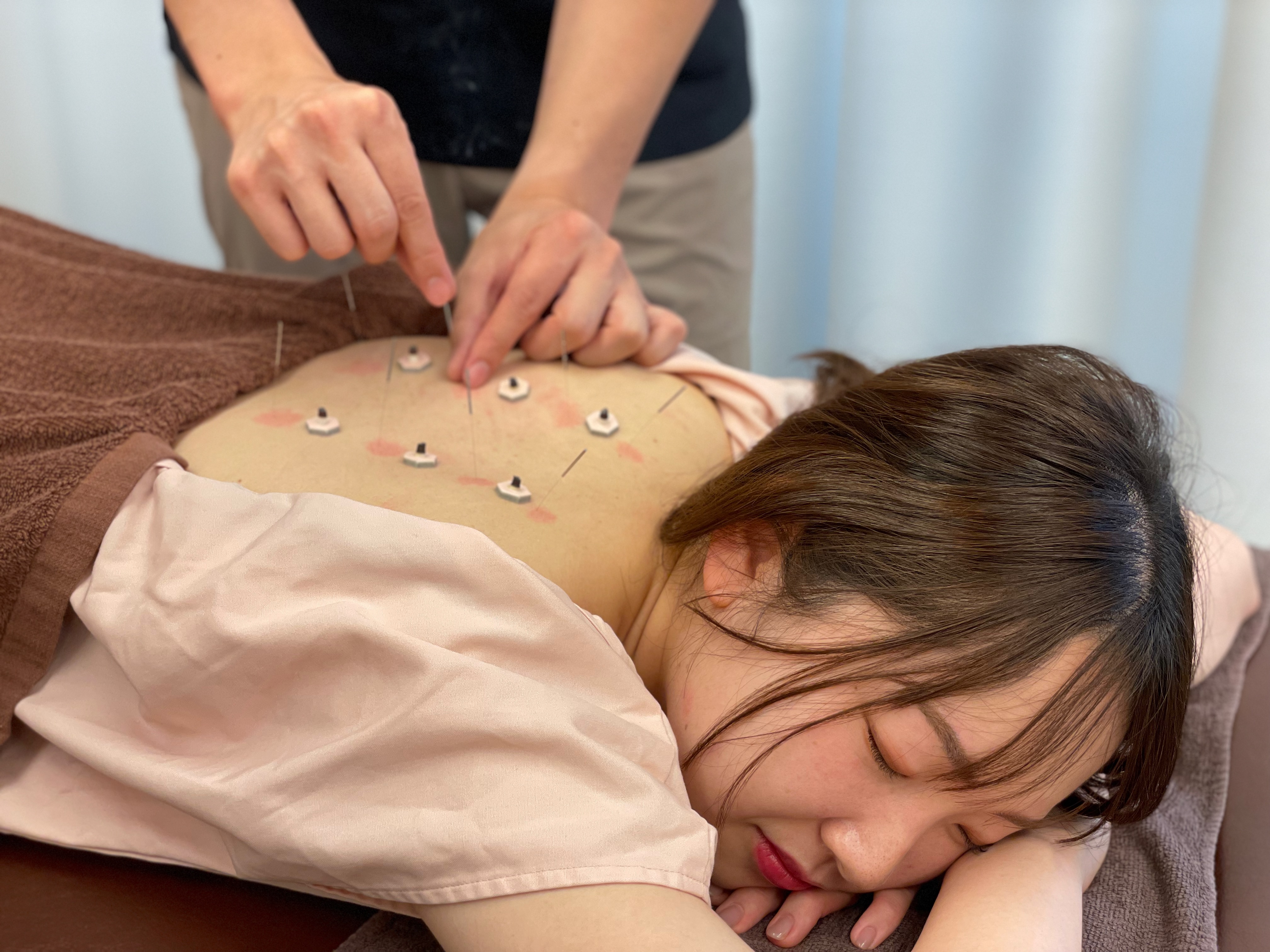 柿木園（かきのきぞの）鍼灸・整体院 初回割引 鍼灸+整体コース　当院の基本コース　人気NO.1鍼灸整体のメニュー画像