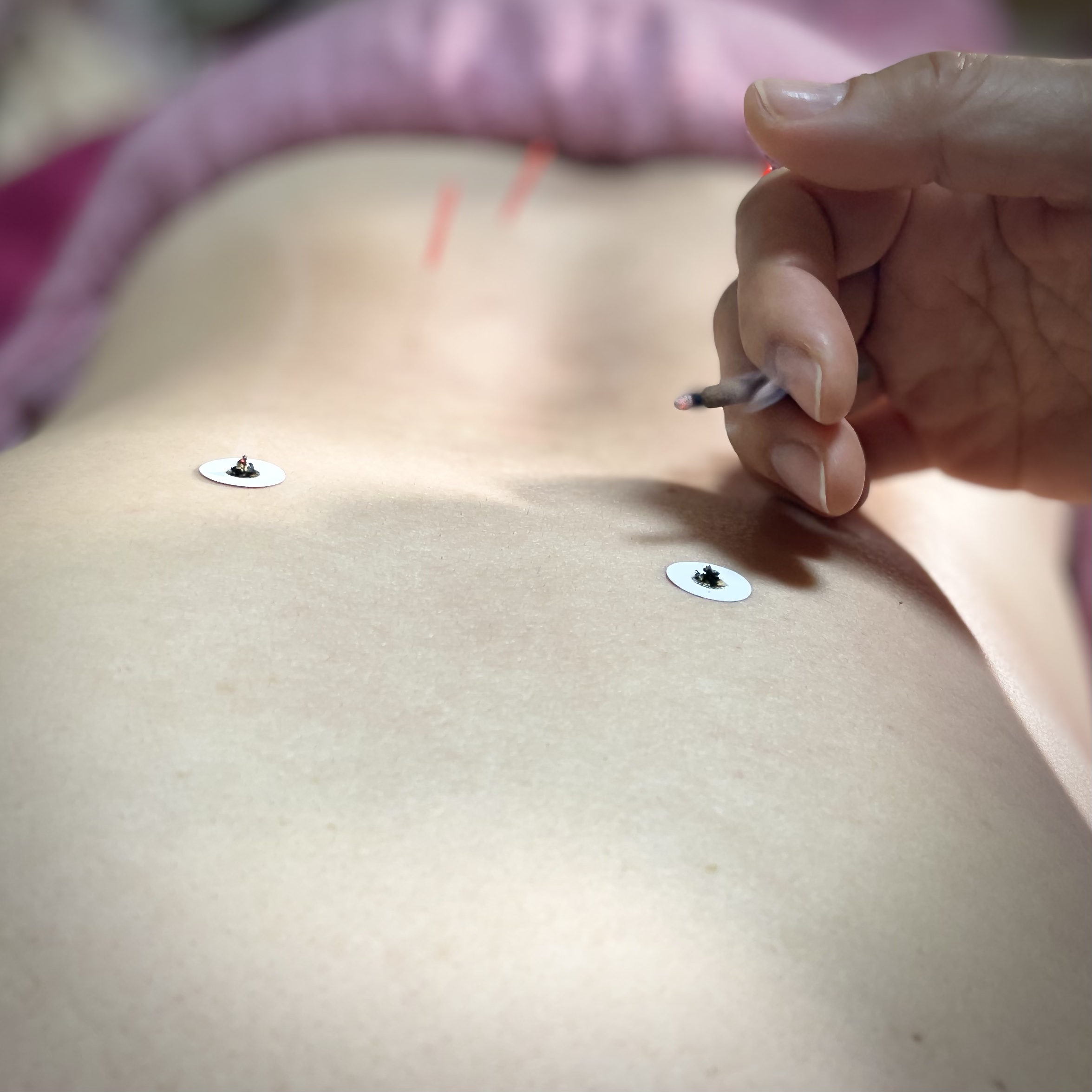 月ノ火鍼灸院 全身鍼灸治療(当院初めての方)のメニュー画像