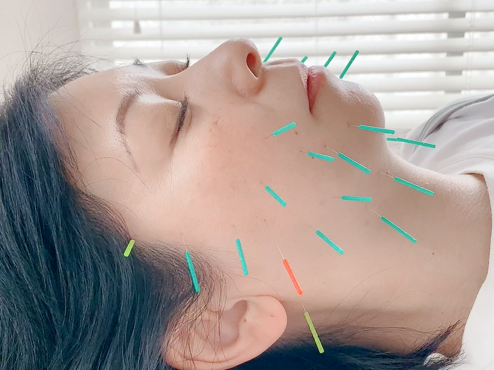 はり灸サロン　totonoi 電気を流す美顔鍼のメニュー画像