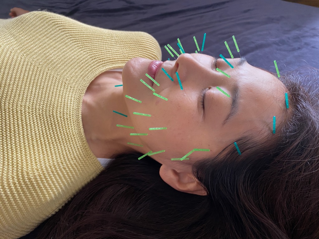 鍼灸院 侑秀 NIIGATA (リピーター限定)ベーシック美容鍼コースのメニュー画像