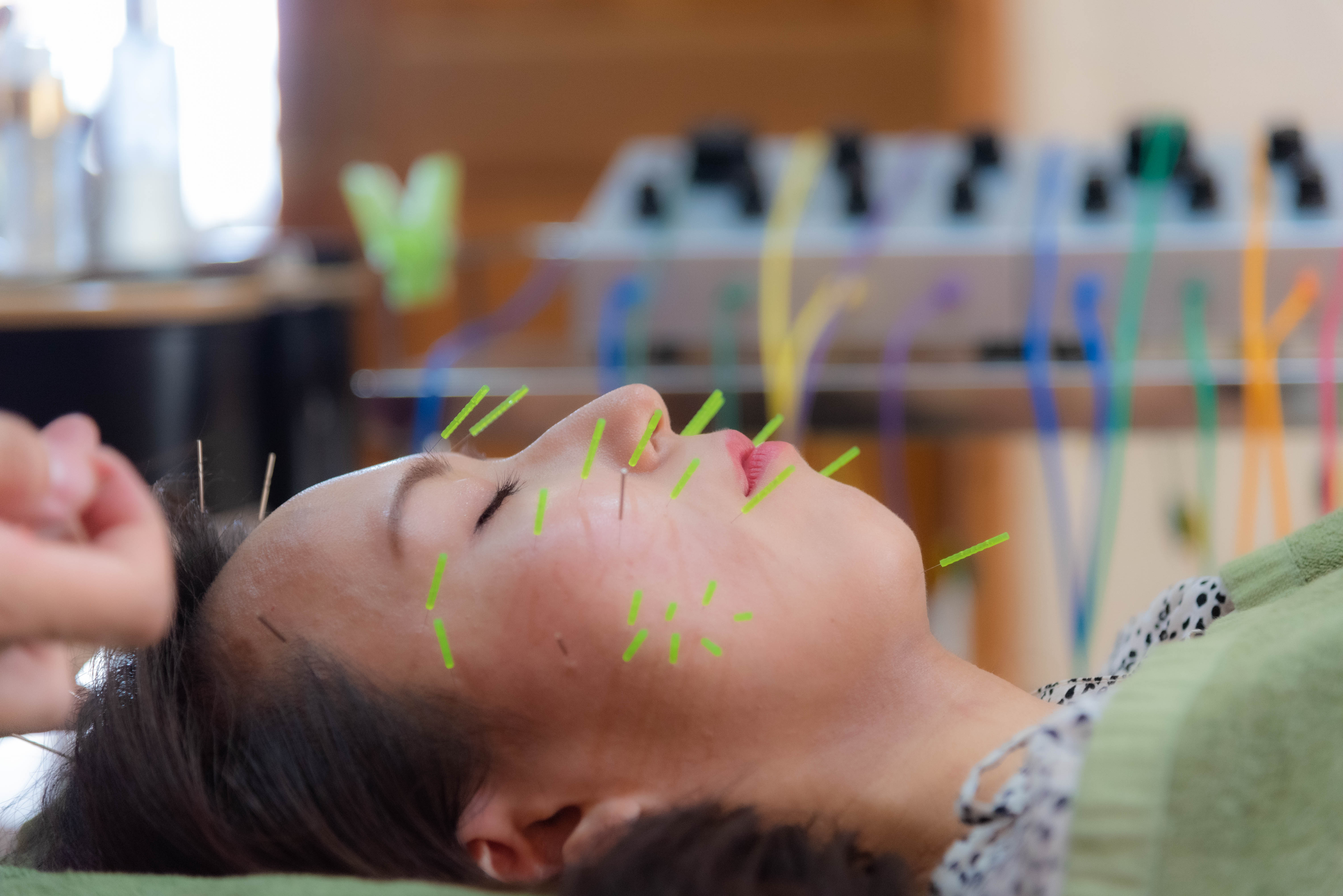 鍼灸マッサージ・美容鍼・ダイエット　藤井治療院 （初診）電気を流さない美容鍼（Aコース）のメニュー画像