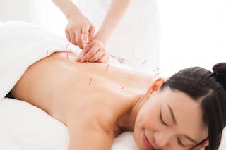 神宮はり灸接骨院 Body鍼灸(20分)※初診料込のメニュー画像