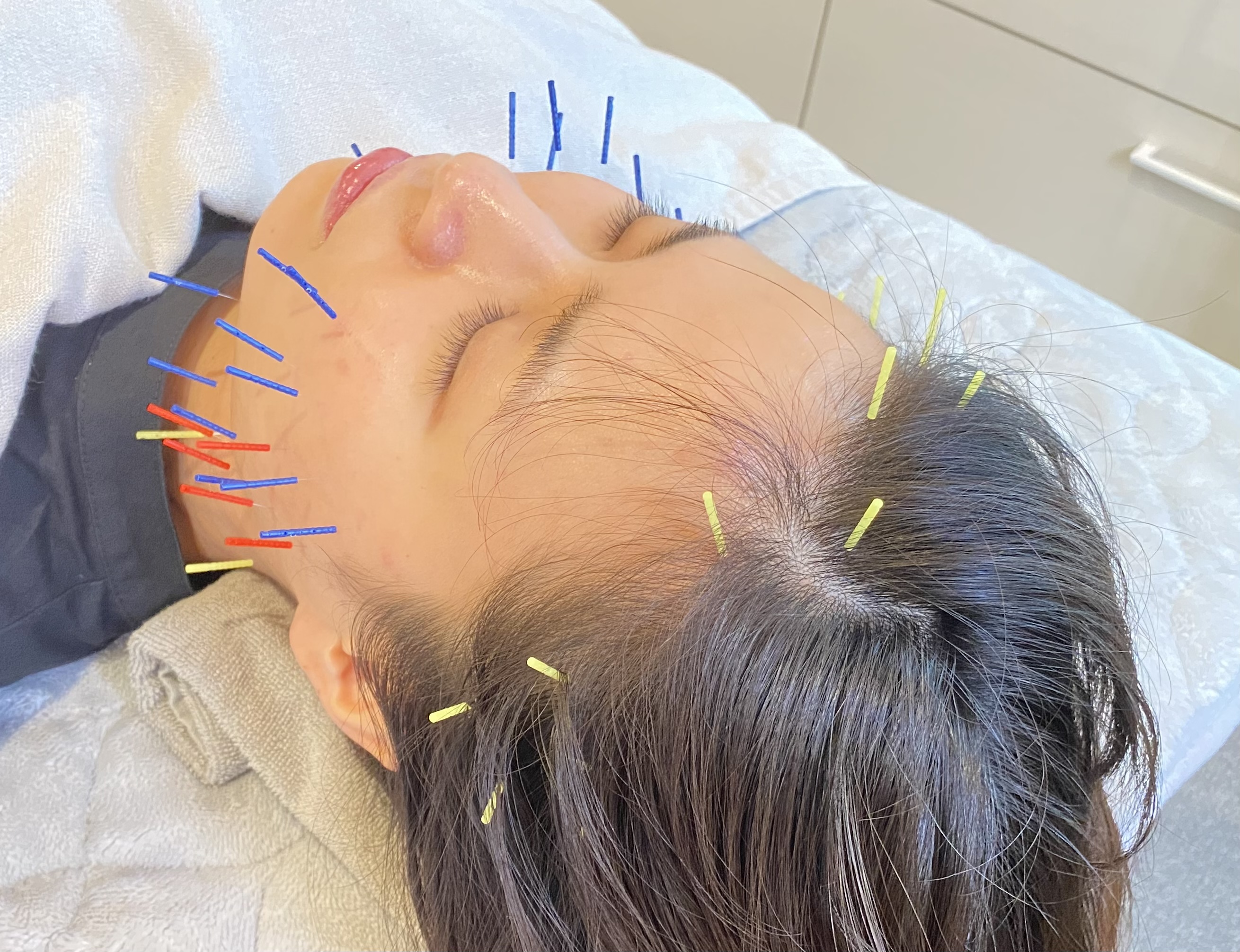 はりきゅうsalon TOTONOE トトノエ整顔のメニュー画像