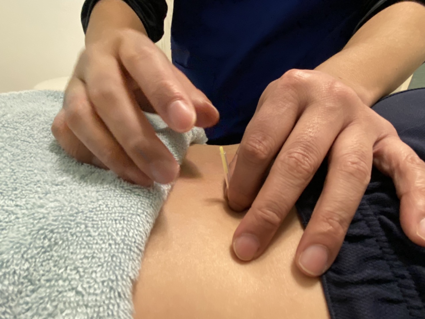 つなぐ鍼灸　トキハナ/AMATO byトキハナ ルート治療-30分-【首/肩/腰/お腹・手足の冷え/自律神経症状に◎】のメニュー画像