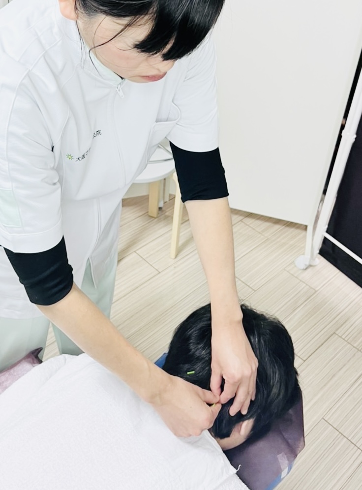 大阪マカリィ鍼灸院（出張専門） 1回目のしんきゅうコースのメニュー画像
