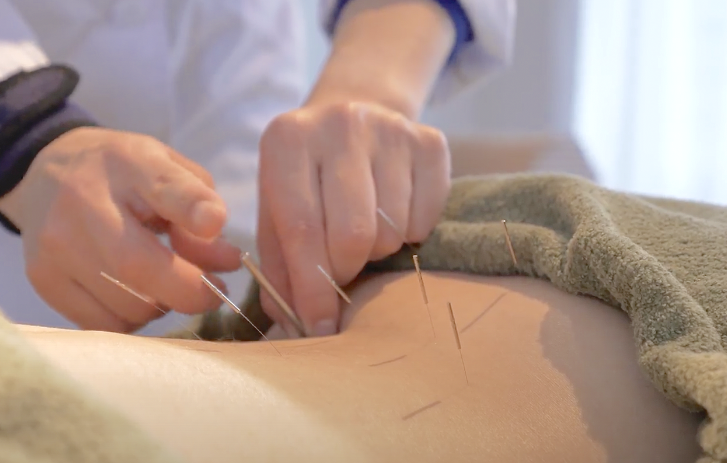 コノハナ・鍼灸院 全身美調整90分のメニュー画像