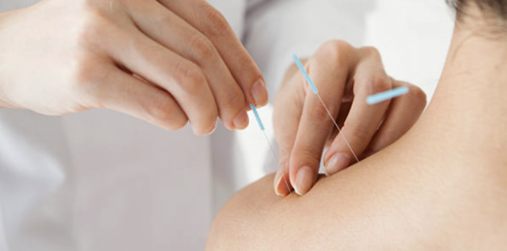 みき鍼灸マッサージ 鍼灸治療のメニュー画像