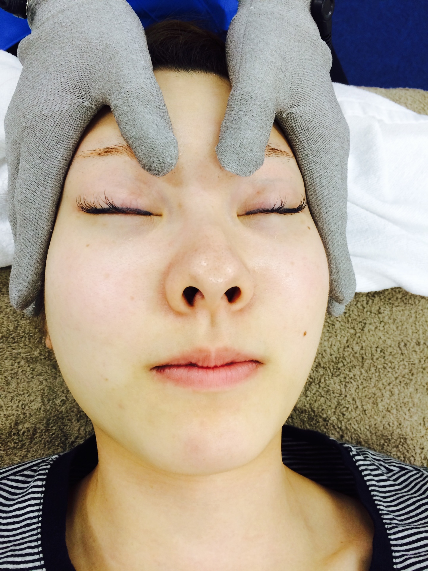 なごみ鍼灸整骨院 リフトアップ電気　（美容鍼とセット割）のメニュー画像