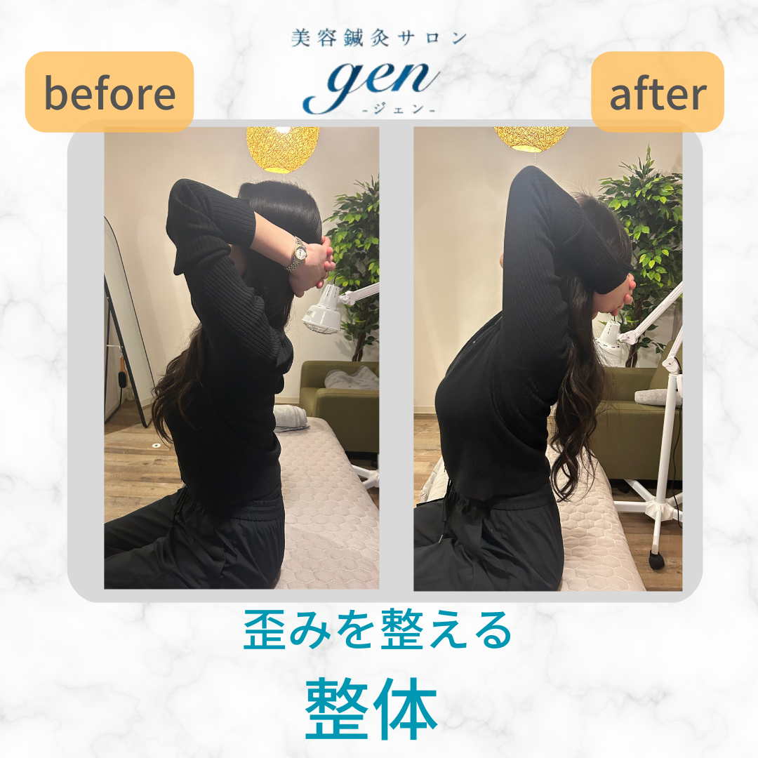 美容鍼灸サロンgen-ジェン- 【歪みを整えたい人向け】整体のメニュー画像
