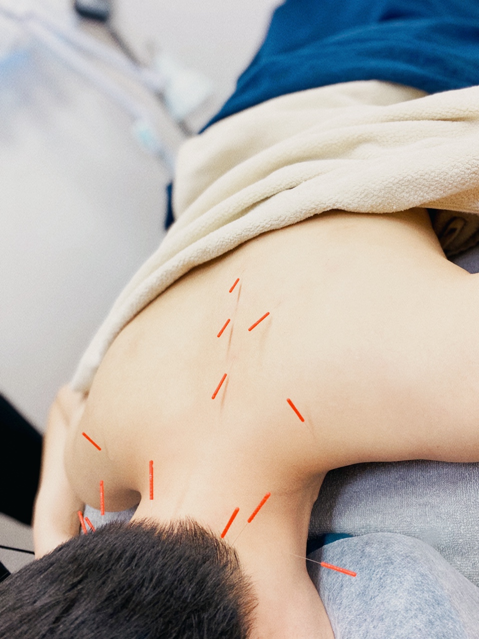 鍼灸サロン ハリシア 【再来院】スポット鍼灸 30分（お身体ｏｒ美容鍼）のメニュー画像