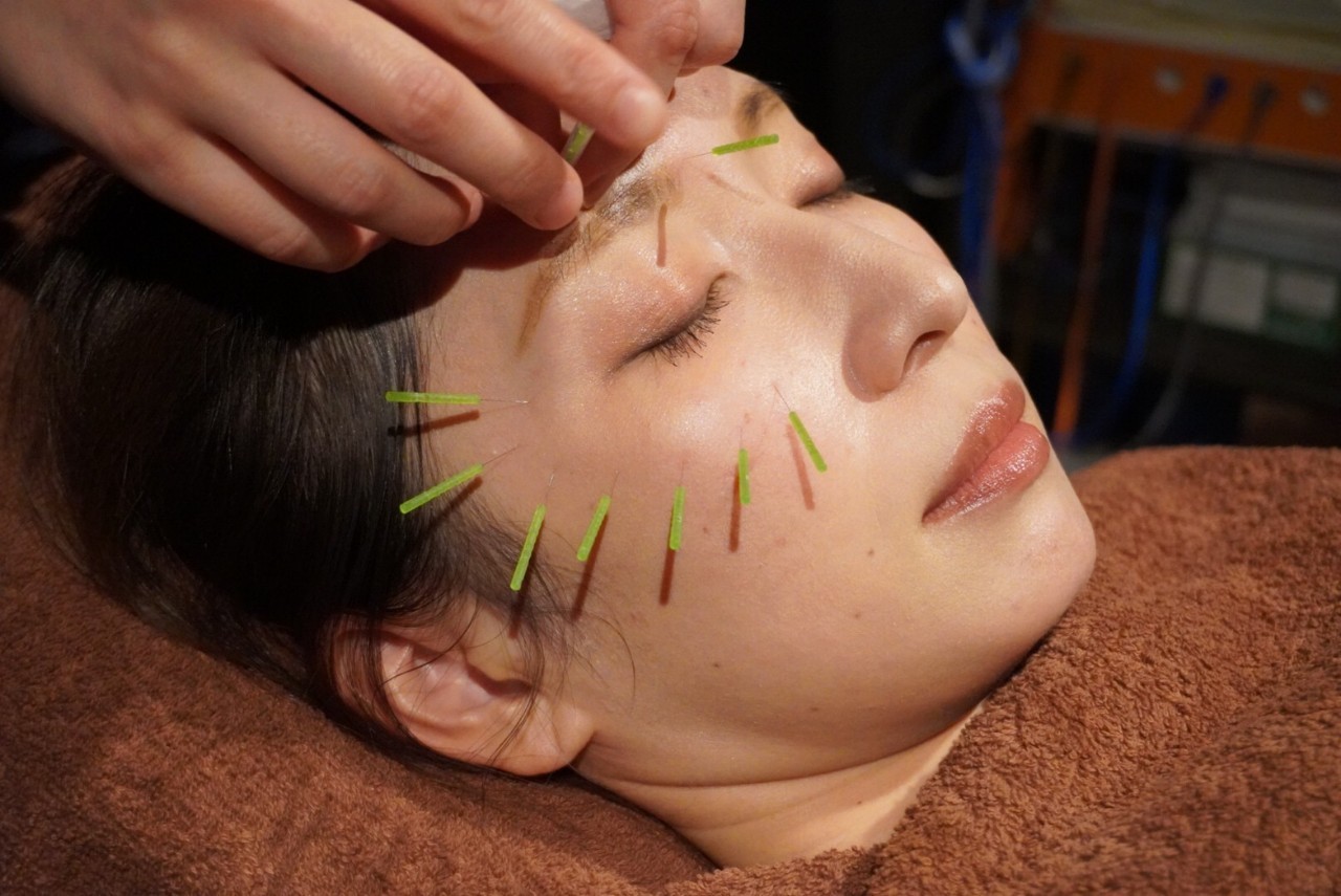 Revive-S(リバイブエス)髪と肌の鍼灸サロン お肌の鍼灸(アトピー・乾燥肌・肌荒れ)+ヒト幹細胞培養液のメニュー画像