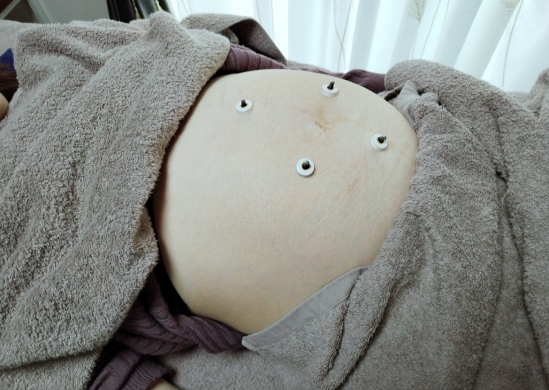 鍼灸Beauty salon 2Face 【再来】鍼灸治療　妊婦さん限定のメニュー画像