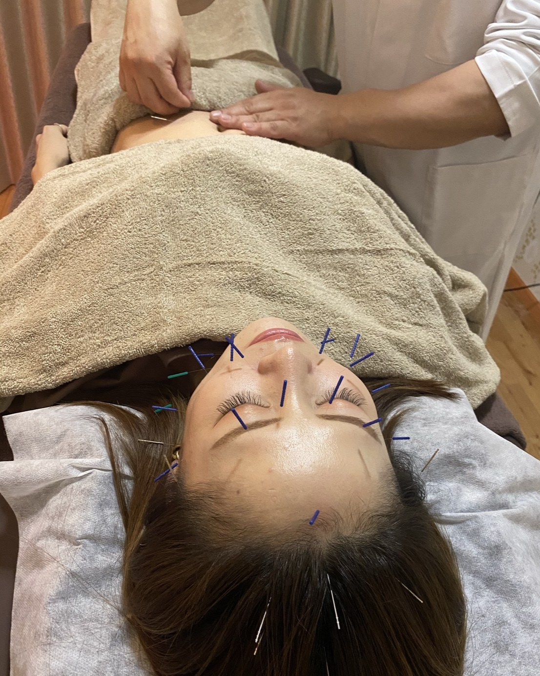 龍樹鍼灸院 反応点治療（初診料別途¥1,000）のメニュー画像