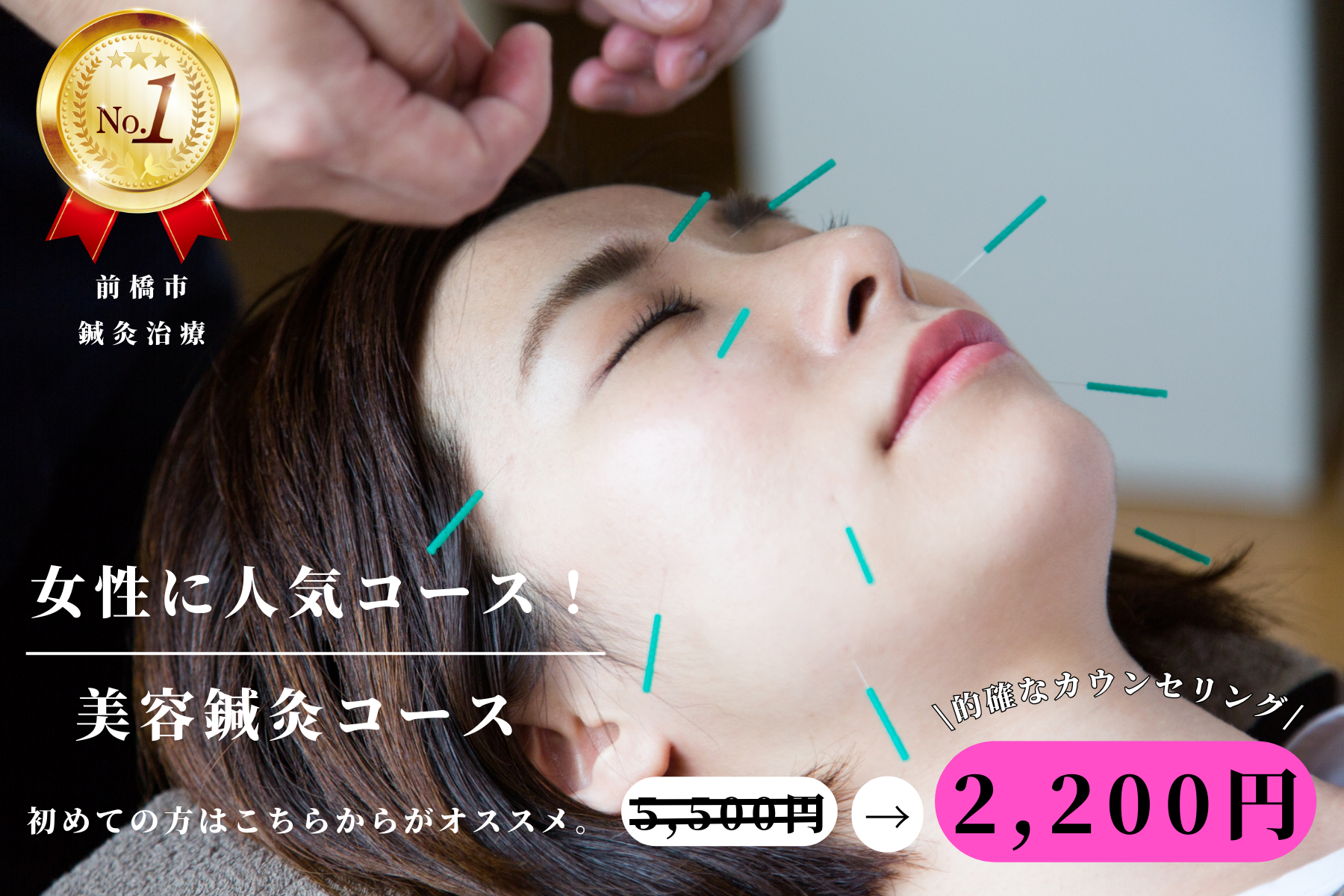 アイメディカル鍼灸整骨院 【今だけ】美容鍼体験2,200円｜通常5,500円→60％OFFキャンペーンのメニュー画像