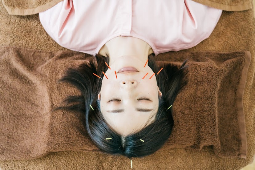 女性のための鍼灸院　teate（テアテ） 【初回限定】美容鍼＋からだの鍼灸のメニュー画像