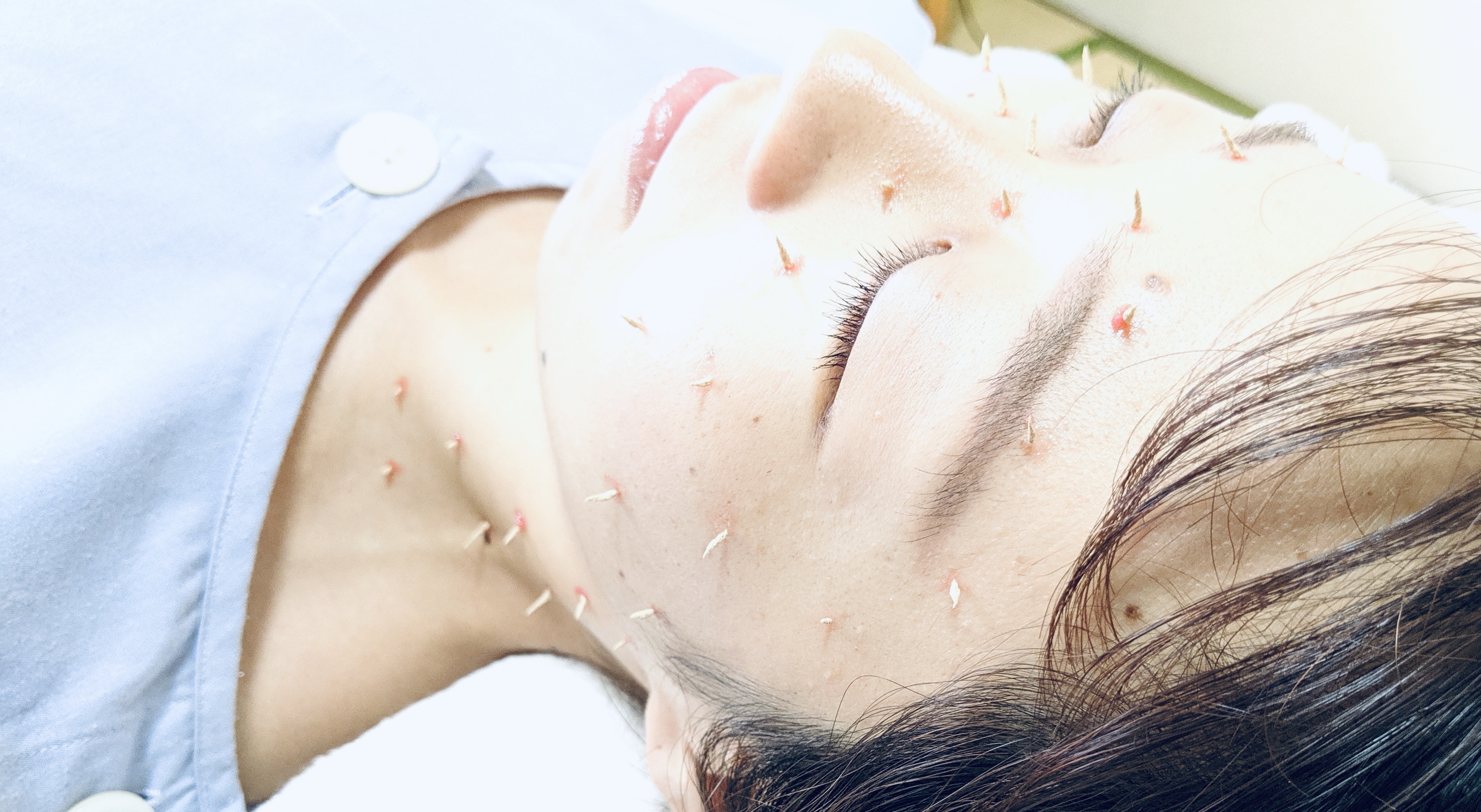 お灸サロン 仙灸堂 かお灸プラスのメニュー画像