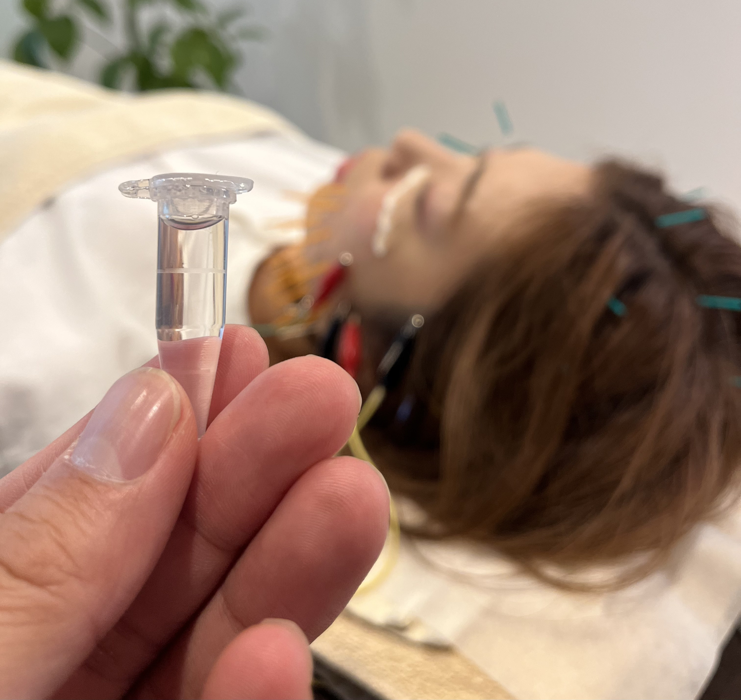 樹はりきゅう・整体院 ヒト臍帯血幹細胞美容液 たるみ・しわ・肌質改善でお悩みの方のメニュー画像