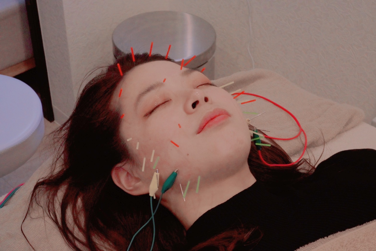 鍼灸ルミナス お試しコースのメニュー画像