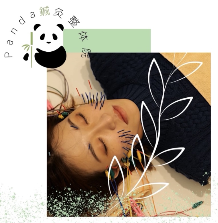 Panda鍼灸整体院(パンダ鍼灸整体院） ●『美容鍼を選択した方のみ　鍼通電』のメニュー画像