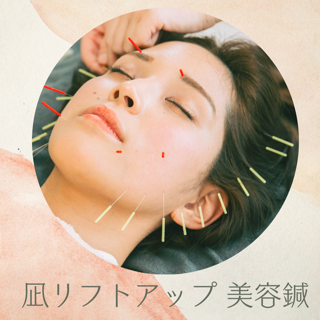 心地治療院　凪ぎのひ 凪 リフトアップ造顔 美容鍼のメニュー画像