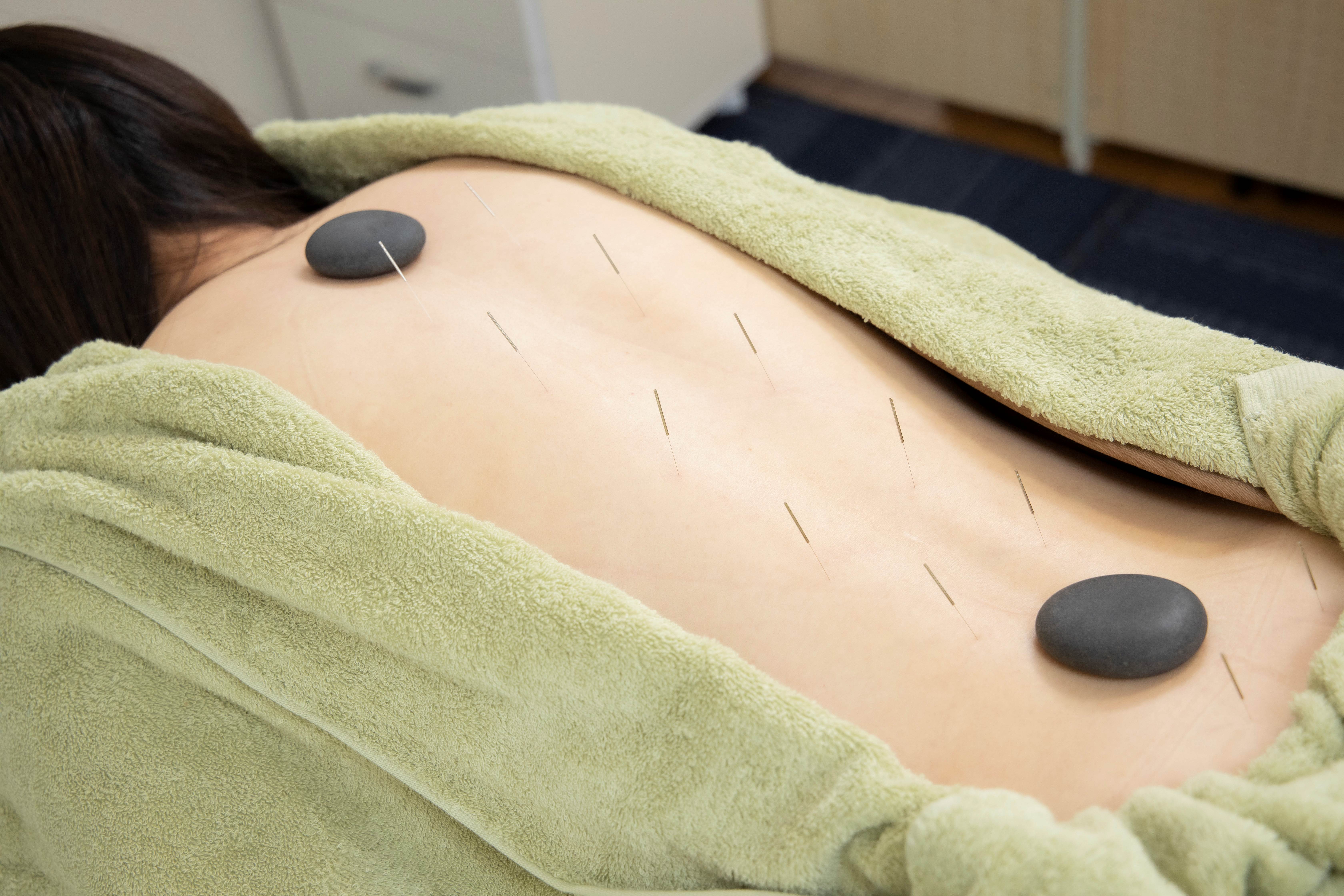 【不妊・逆子・疲れケア】船橋ウィメンズ鍼灸院 【ヘルスケア鍼灸】ロング１１０分のメニュー画像