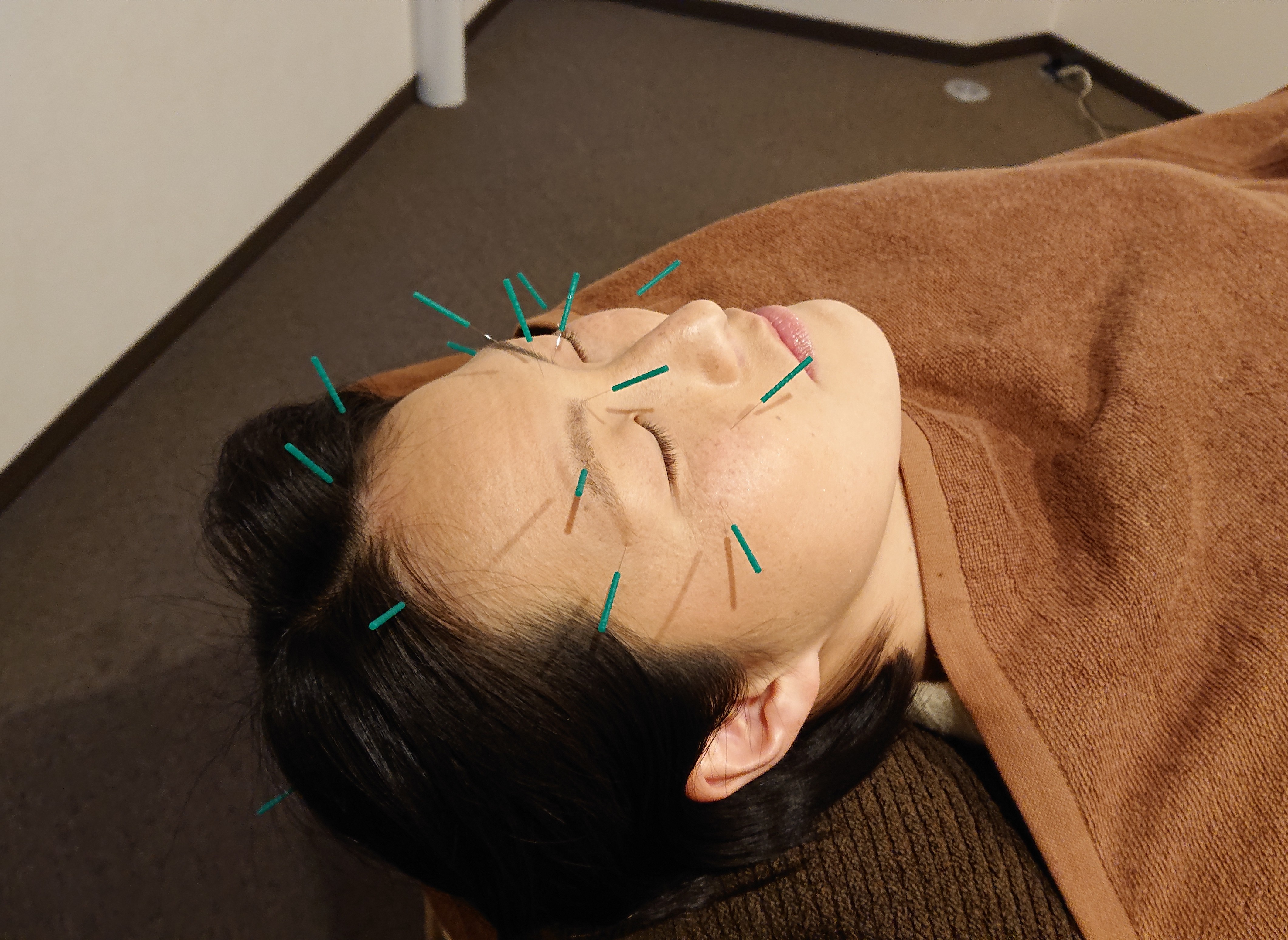 眼精疲労専門鍼灸サロン shiny ショートコースのメニュー画像