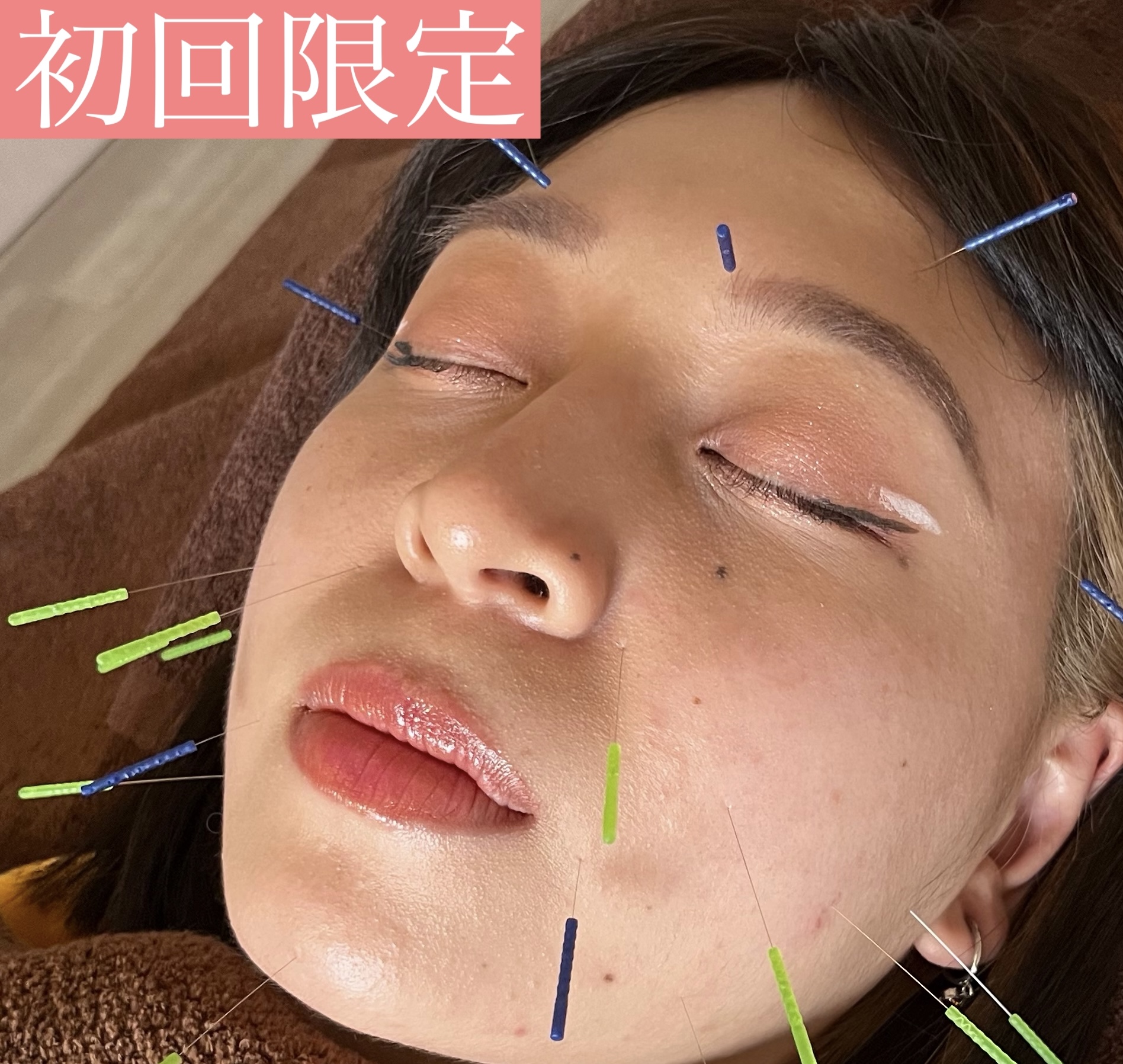 鍼灸サロンLieN 【初回限定】プレミアム美容鍼灸コースのメニュー画像