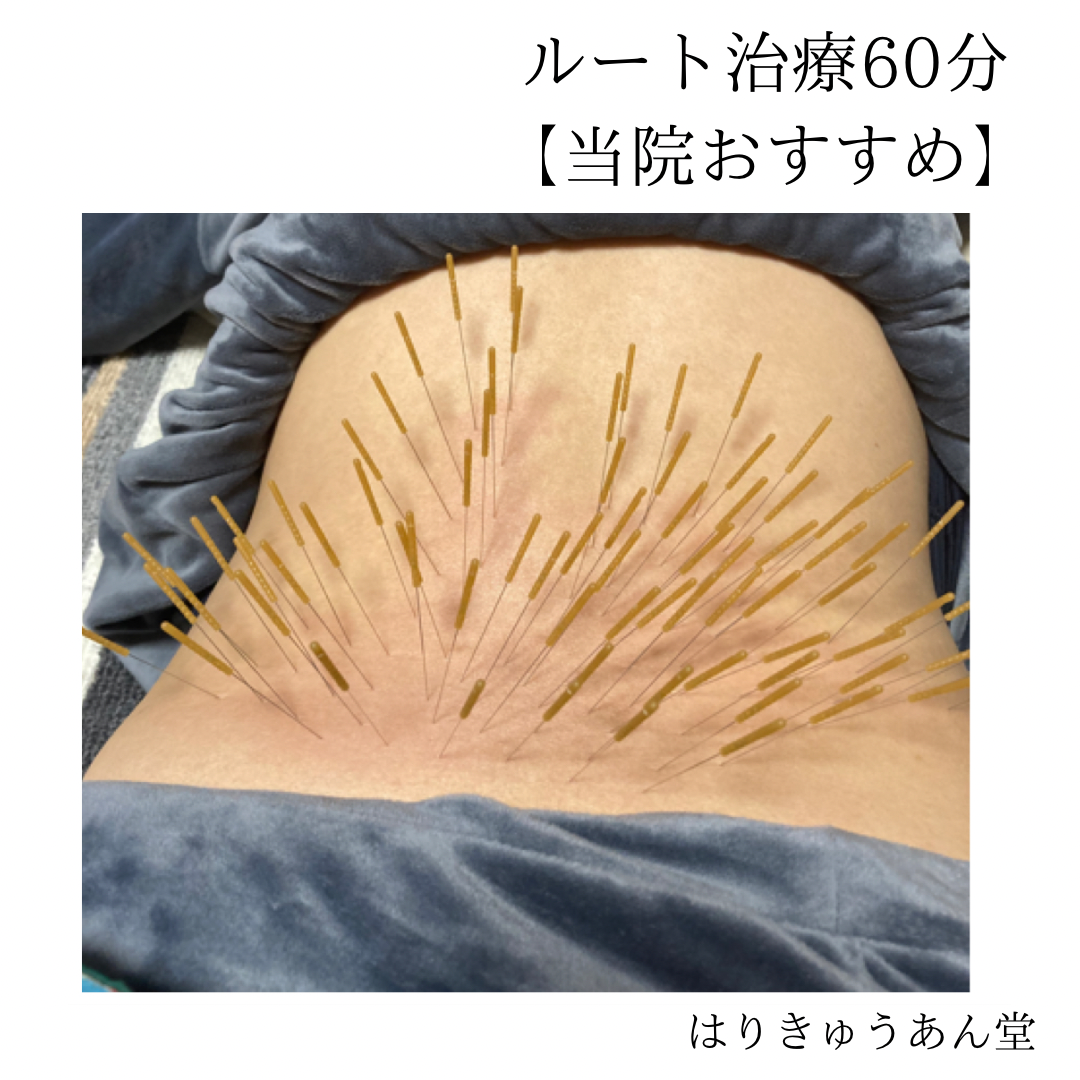 はりきゅうあん堂【ルート治療｜女性専用】 ルート治療60分【当院おすすめ】のメニュー画像