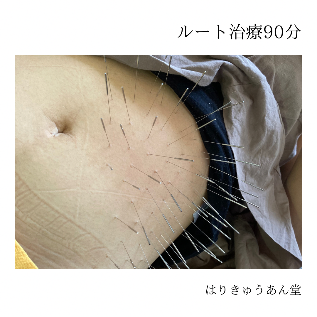 はりきゅうあん堂【ルート治療｜女性専用】 ルート治療90分のメニュー画像