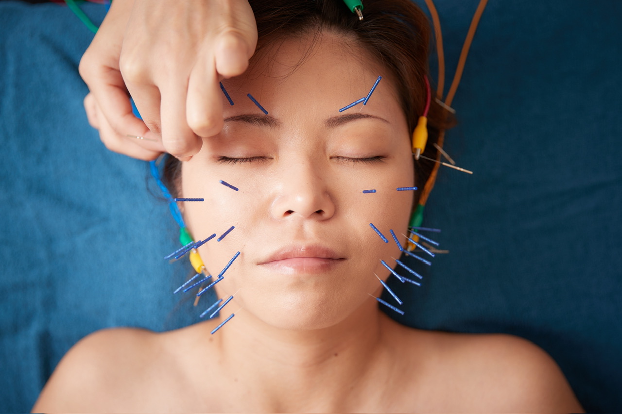 美楽鍼 琉球再生エッセンス美容鍼のメニュー画像