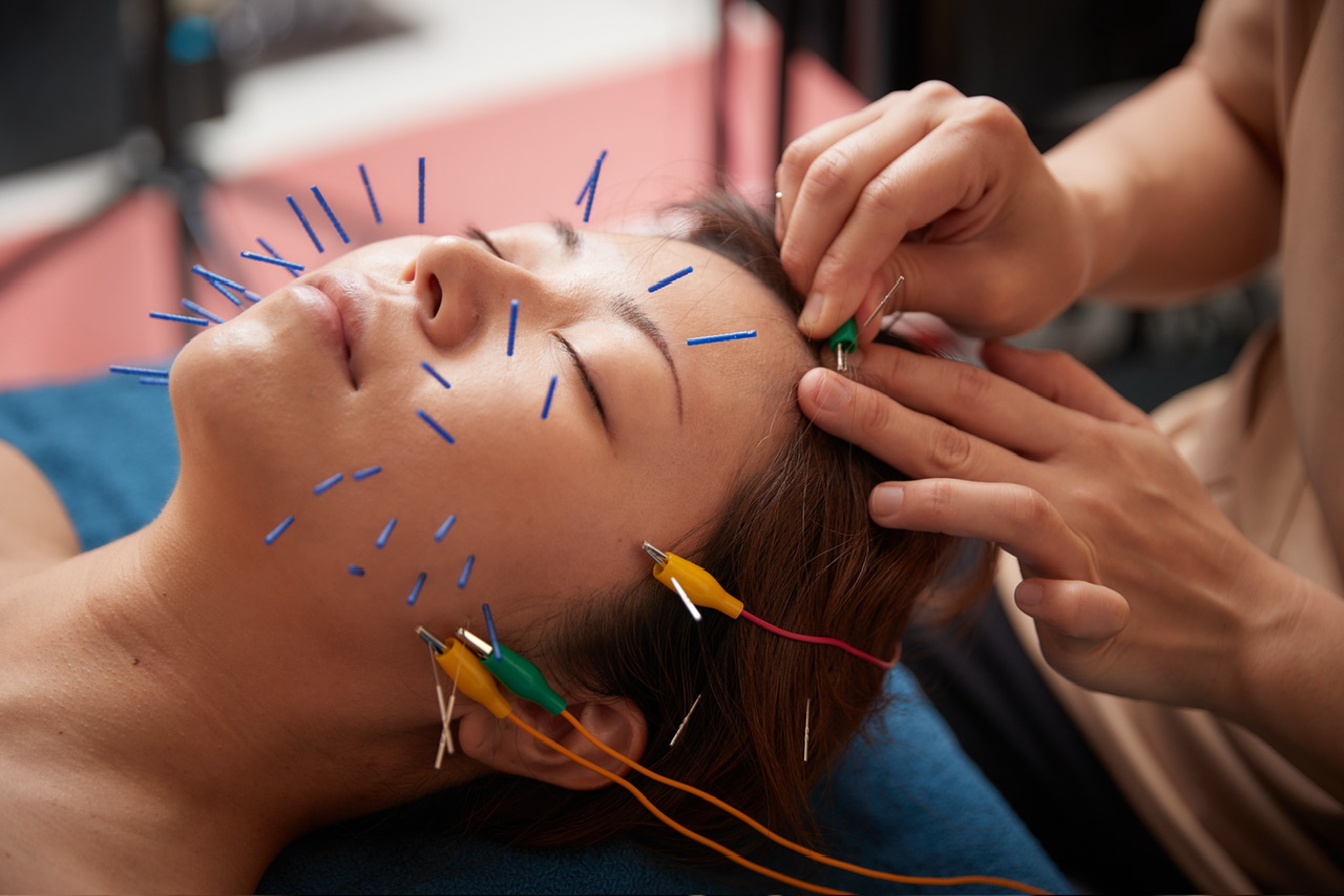 美楽鍼 オーダー美容鍼のメニュー画像