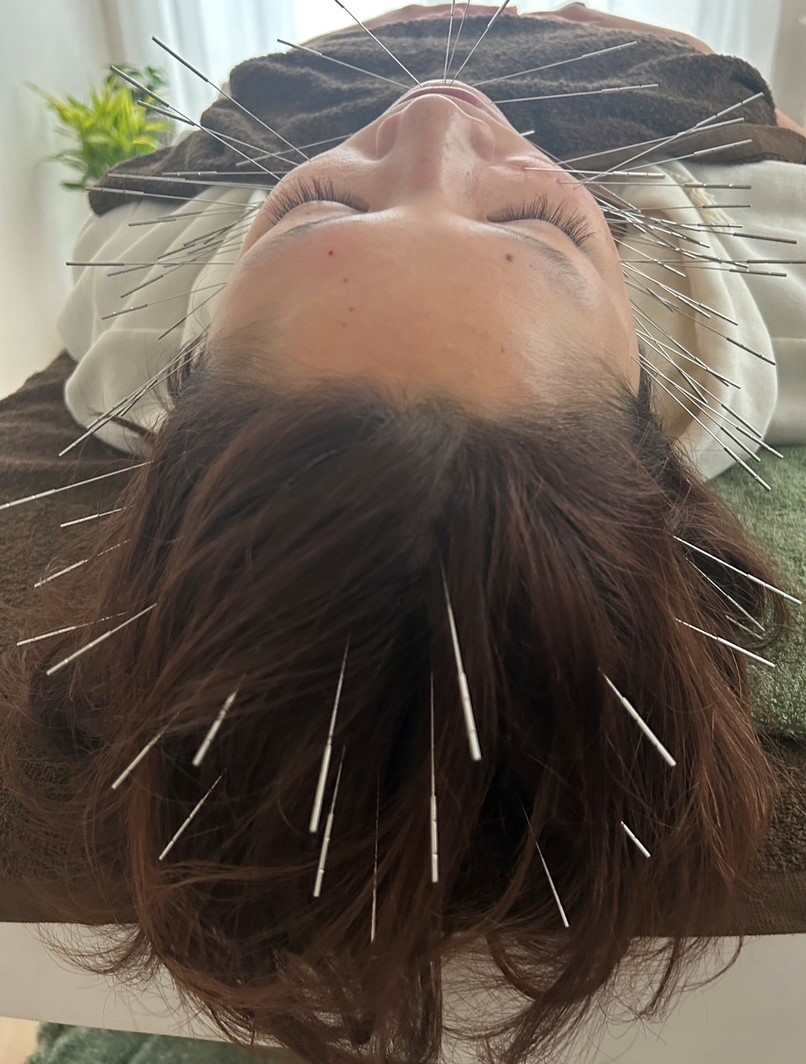 maryu358鍼灸・整体院 ルート治療90のメニュー画像