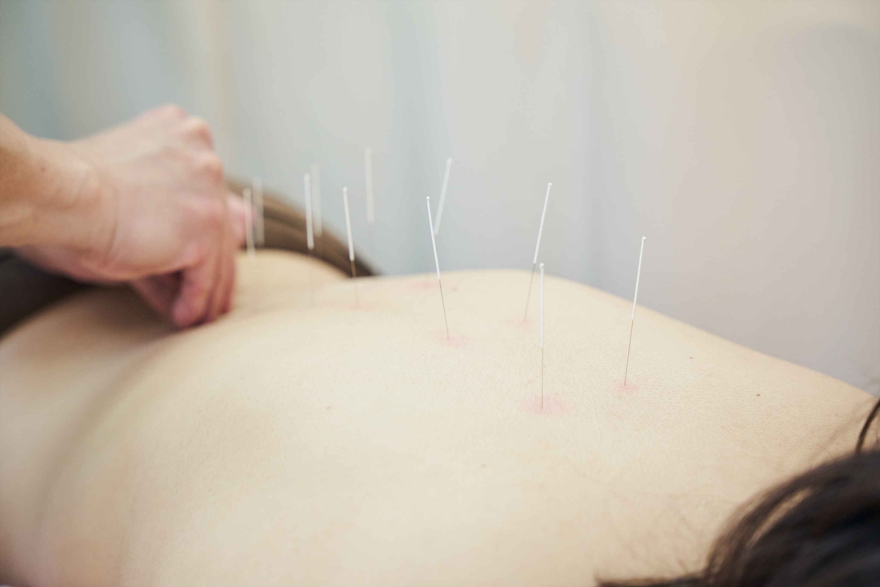 大阪 前田鍼灸院　（旧：前田針灸接骨院） 大人針灸治療（2回目以降）のメニュー画像